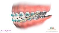 AvA Orthodontics & Invisalign image 6